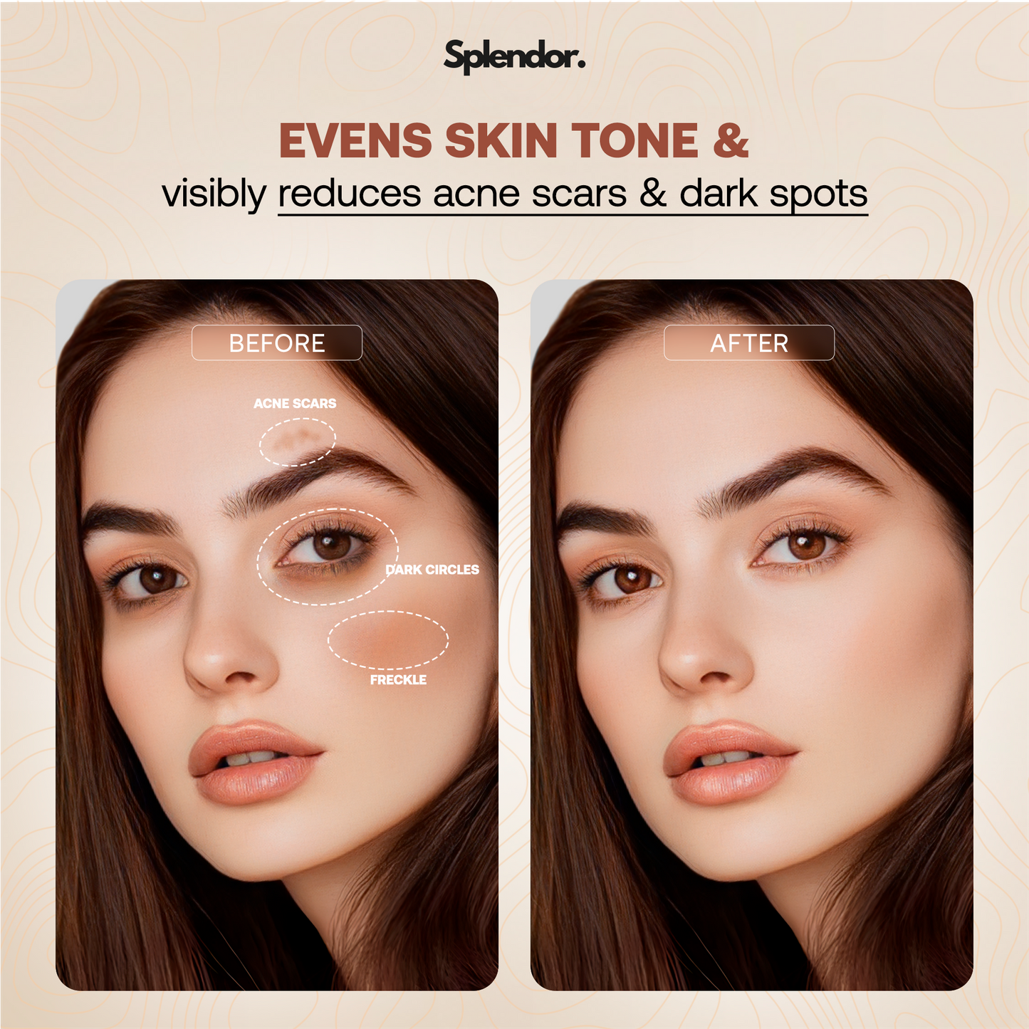 Serum Boosted Skin Tint Balm - Splendor